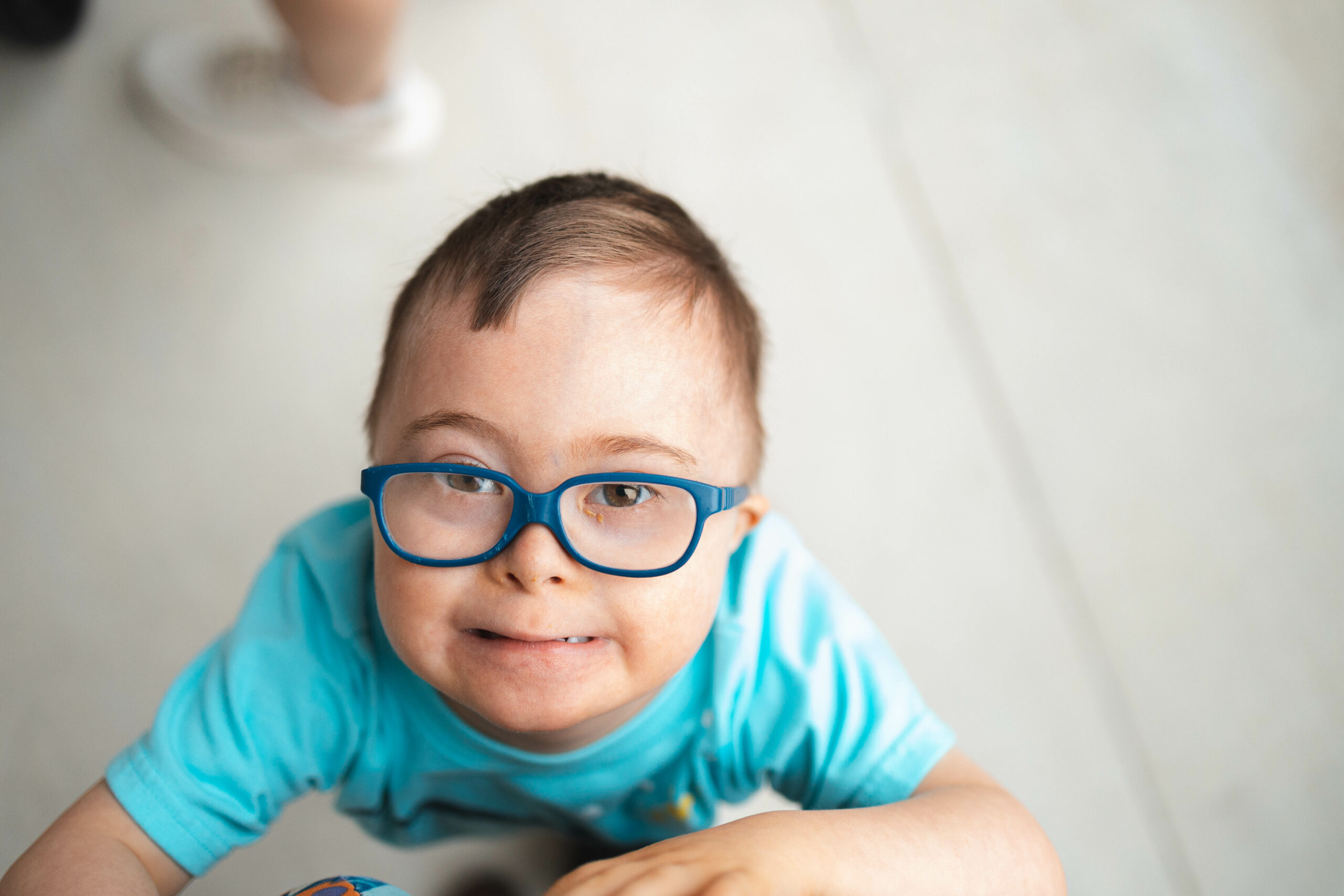 toddler with down syndrome wearing glasses for a visual impairment